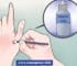 Productos de farmacia para quitar verrugas