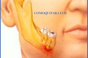 cirugía dental e implante dental causas y tratamiento