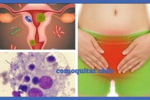 Salud e Higiene Intima Femenina Correctas | Prevención Causas y Tratamientos