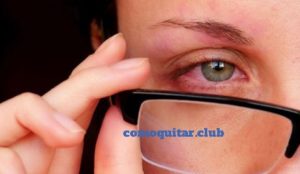 Como quitar picazon, lagrimeo y enrojecimiento de los ojos Causas y tratamientos