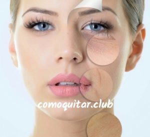 7 formas naturales de cuidar la piel del rostro maltratada