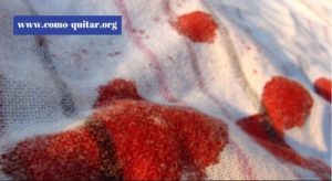 Como quitar manchas de sangre seca: tips efectivos